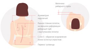 метод шрот у взрослых